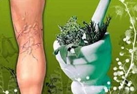 varisli damarların tedavisi için şifalı bitkiler