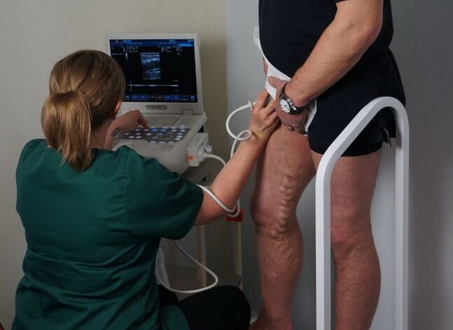 varisli damarlar için lazer pıhtılaşmasından önce damarların incelenmesi